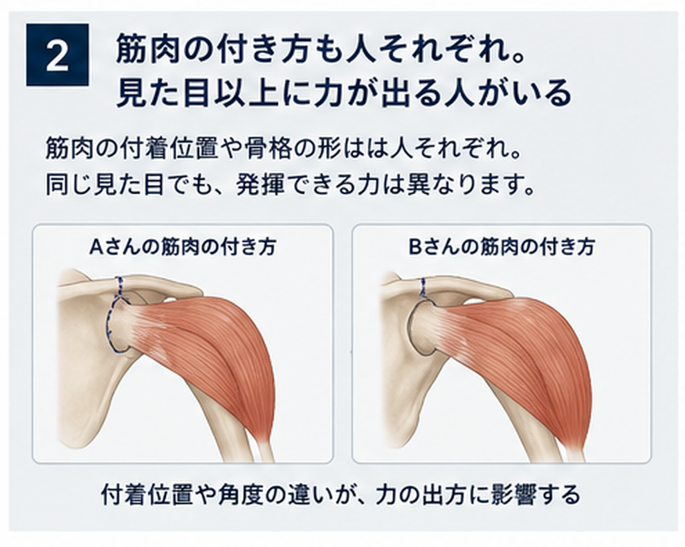 筋や腱の付着位置など身体構造には個人差があることを示す概念図